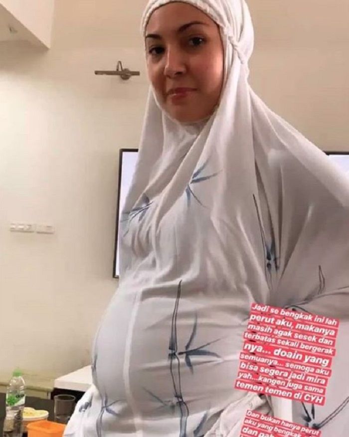 Ratna Galih memperlihatkan perutnya yang membengkak karena dipenuhi dengan cairan.