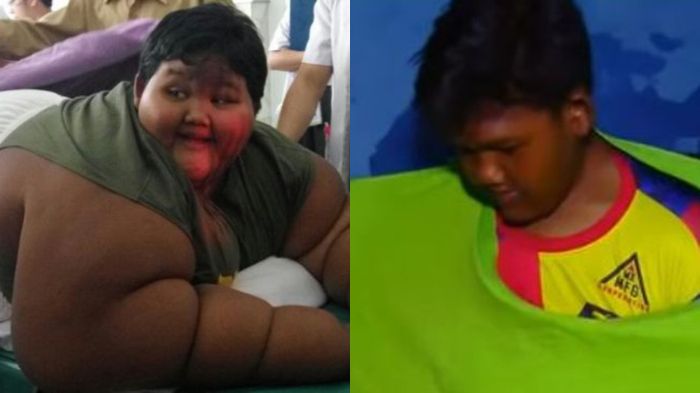 Arya Permana dulu dan sekarang. (Kolase KOMPAS.com/Reni Susanti & tangkap layar YouTube Trans7 Official)