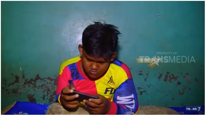 Inilah Penampilan Arya Permana Sekarang, Sang Bocah Obesitas Usai Turunkan Berat Badan Hingga 102 Kg