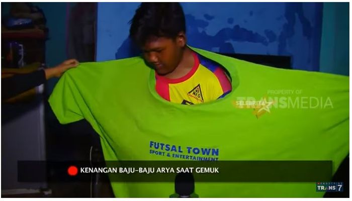 3 Cara Bocah Obesitas, Arya Permana, Turunkan Berat Badannya Sampai 102 Kg
