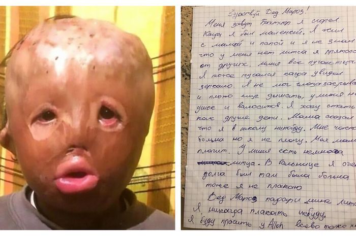 Seorang anak tulis surat untuk Santa agar diberi wajah baru