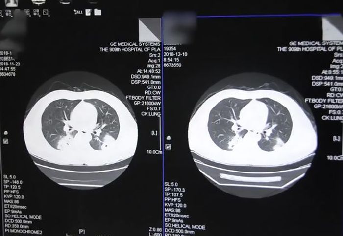 Hasil Scan X-Ray oleh petugas medis rumah sakit