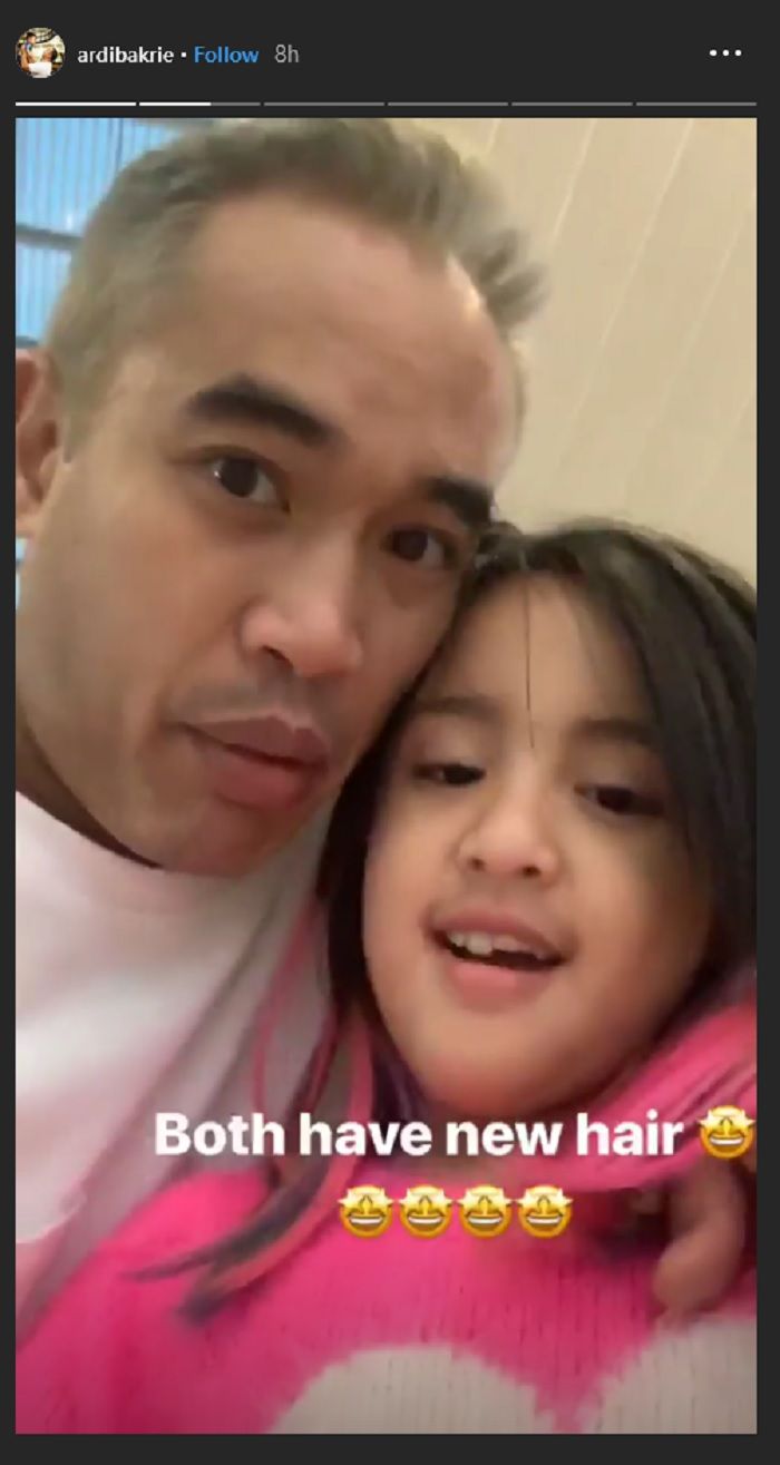 Tampilan rambut baru Ardi Bakrie dan Mikhayla