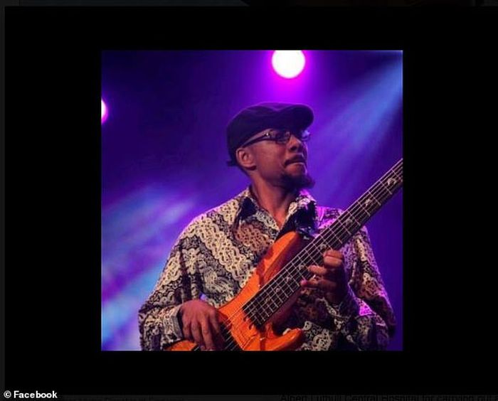 Musisi India yang lakukan operasi kepala sambil bermain gitar