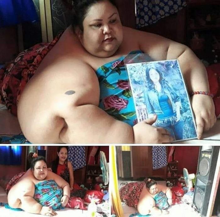 Titi Wati wanita berberat badan 350 Kg.