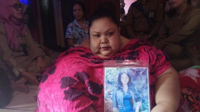 Meski Sepele, Kebiasaan Ngemil Rupanya Jadi Penyebab Titin Miliki Bobot 300 Kg Hingga Tak Bisa Apa-a