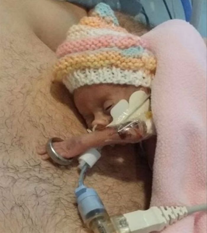 Tangan Mollie yang hanya sebesar cincin pernikahan