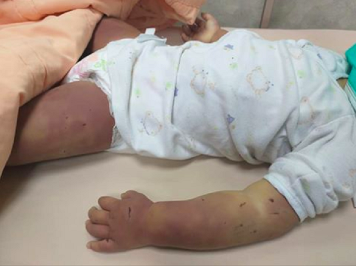 Apple Daily
Luka sang bayi