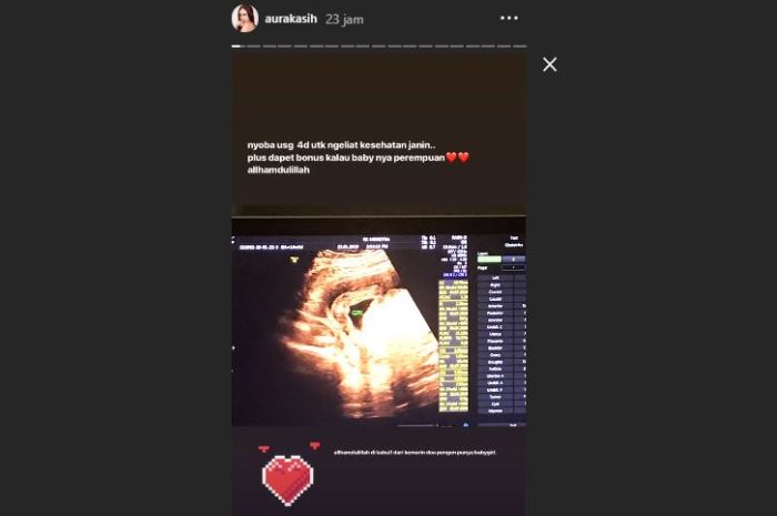 Unggahan Instagram Story milik Aura Kasih soal hamil anak perempuan.