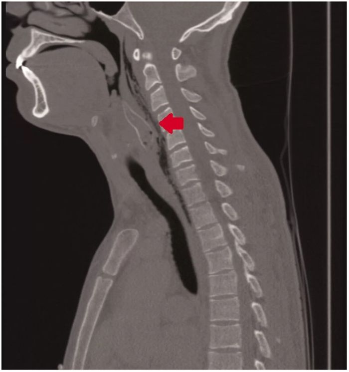 CT Scan menunjukkan di mana tubuh utama ikan bersarang