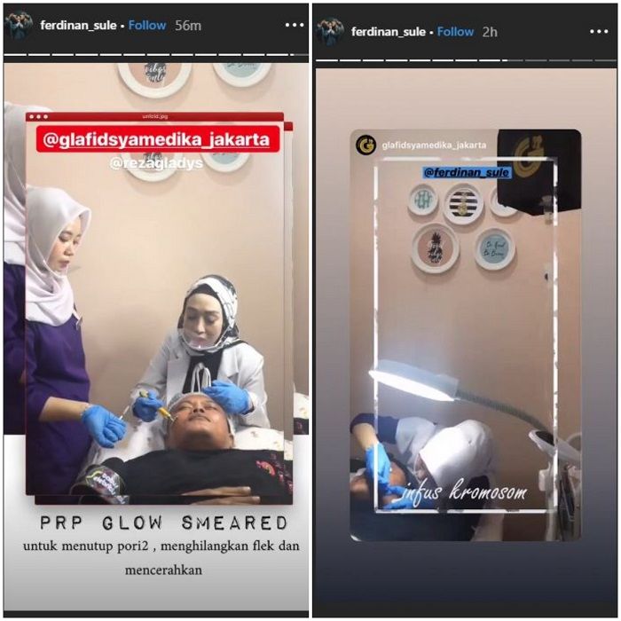 Perawatan <a href='https://pontianak.tribunnews.com/tag/sule' title='Sule'>Sule</a>