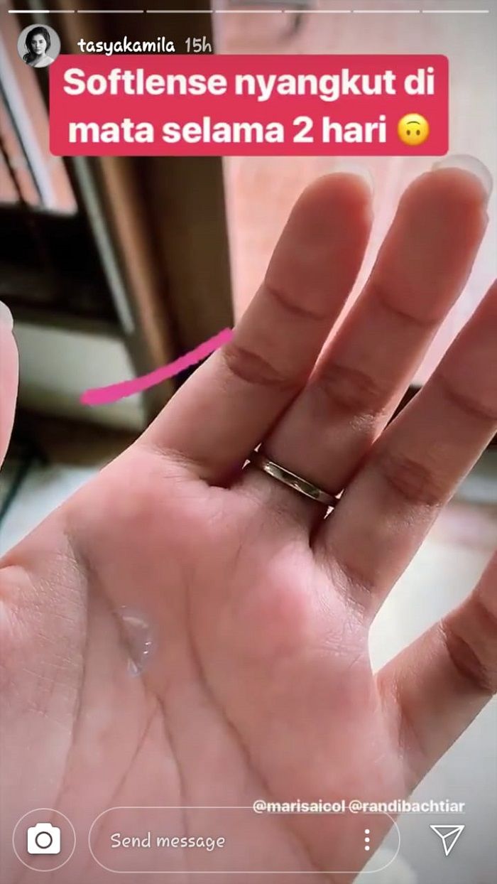 Kondisi mata Tasya Kamila pasca insiden softlens nyangkut di matanya selama 2 hari