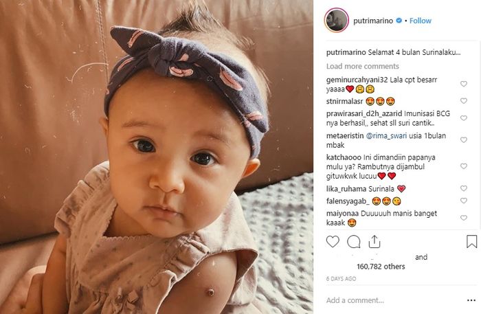 Berusia 4 Bulan, Luka di Tangan Anak Putri Marino Jadi Sorotan Warganet