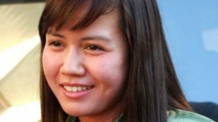 Nita Thalia sebelum melakukan operasi plastik