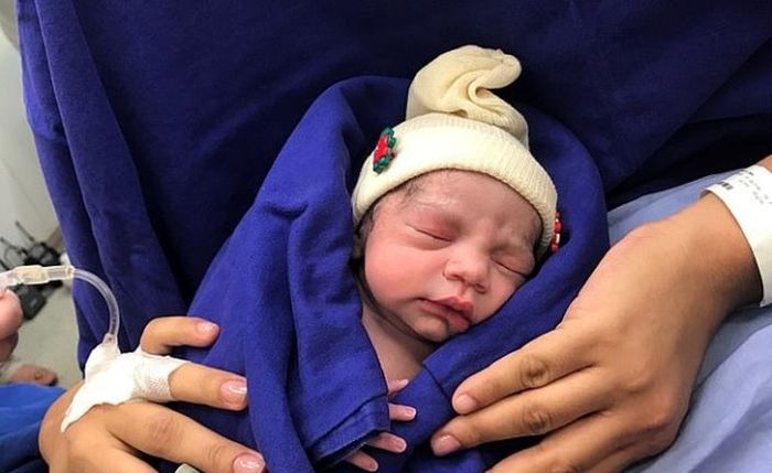 Bayi pertama yang lahir dengan transplantasi rahim dari mayat