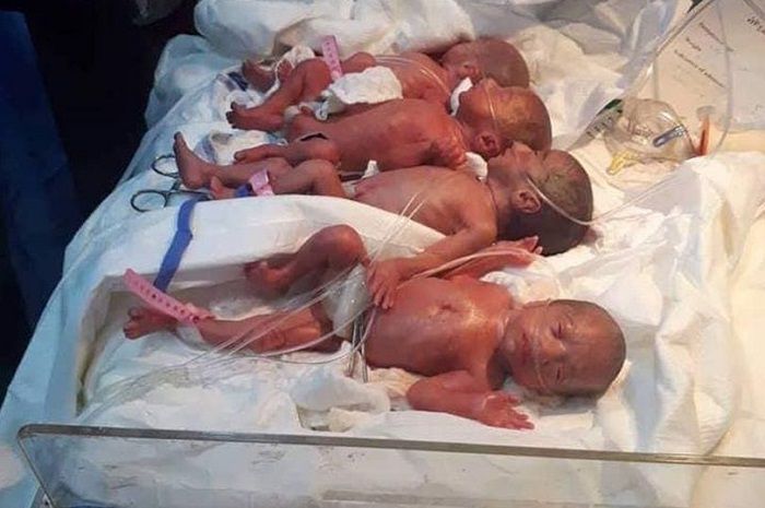 Bayi kembar 7 di Irak