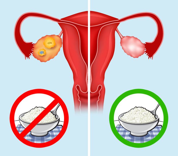 Keju Cottage meningkatkan kesehatan organ intim wanita
