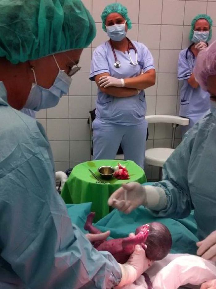 Express
Bayi ini akhirnya berhasil di keluarkan dari janin sang ibu.