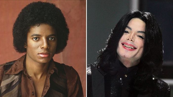 Michael Jackson, saat tenar dirinya tak puas dengan kondisi fisiknya. Hingga akhir hayatnya Kik of Pop ini dalam kondisi menyedihkan
