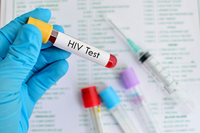 Tes HIV | Ilustrasi