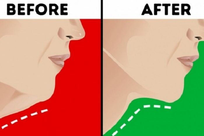 Perbedaan leher sebelum dan sesudah melakukan enam tips.