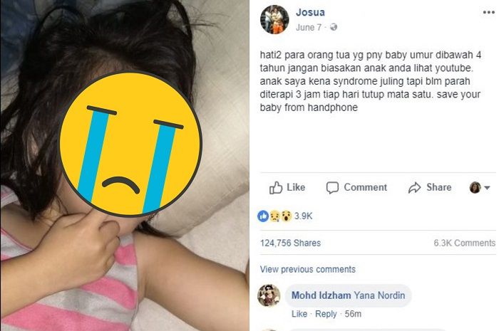 Soerang balita alami penyakit mata karena terlalu sering main gadget