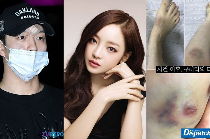 Go Hara dan mantan kekasihnya