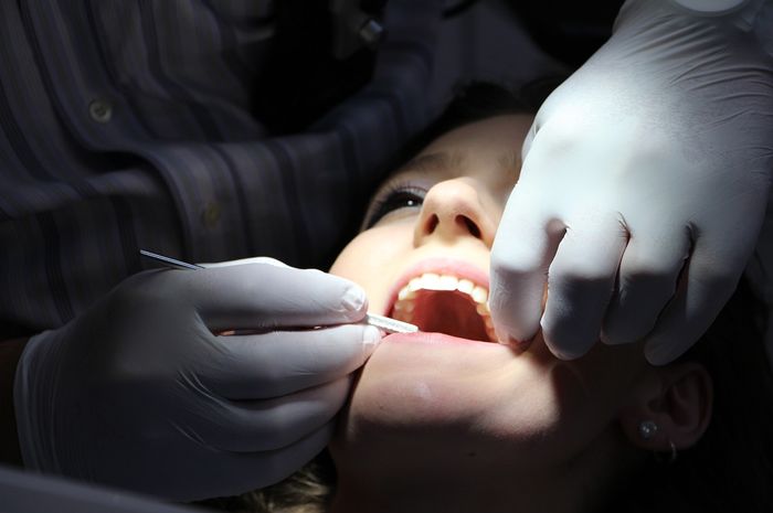 Gigi berlubang bisa sebabkan penyakit jantung? Ini jawaban dokter gigi