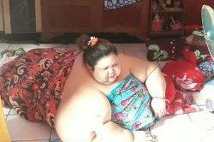 Gara-gara Hobi Ngemil, Titi Wati Berbobot 350 kg Hingga Dijuluki Wanita Tergemuk di Kalimantan Tenga