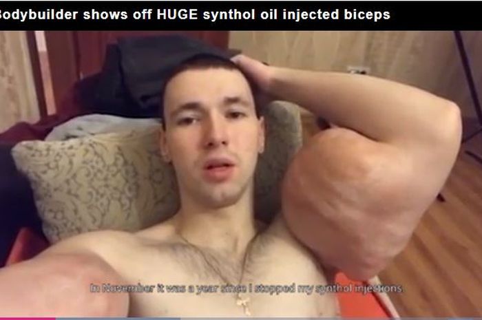 Pria asal Rusia, Kirill Tereshin, menyampaikan pengakuan mengejutkan setelah memiliki otot bisep men