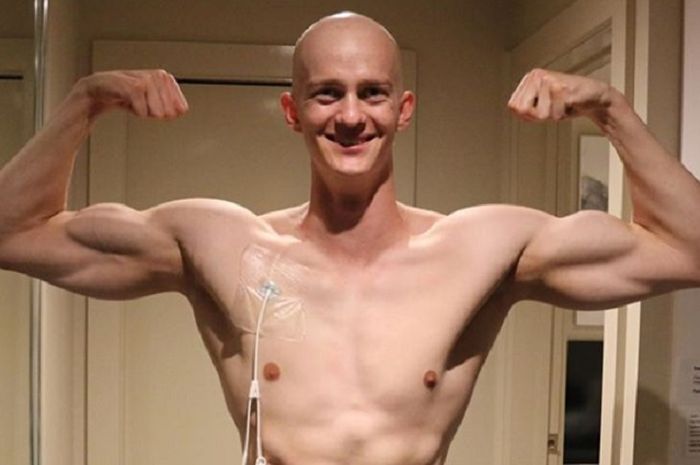 James Kearsley, pria berusia 22 tahun asal Tasmania, Australia dua kali berhasil mengalahkan penyakit kanker yang menyerangnya.