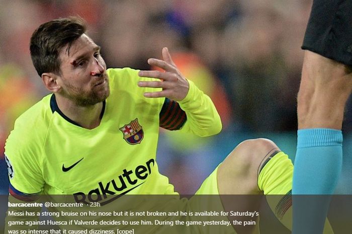 Wajah megabintang Barcelona, Lionel Messi terluka hingga berdarah akibat duel dengan Chris Smalling sat leg pertama perempat final Liga Champions