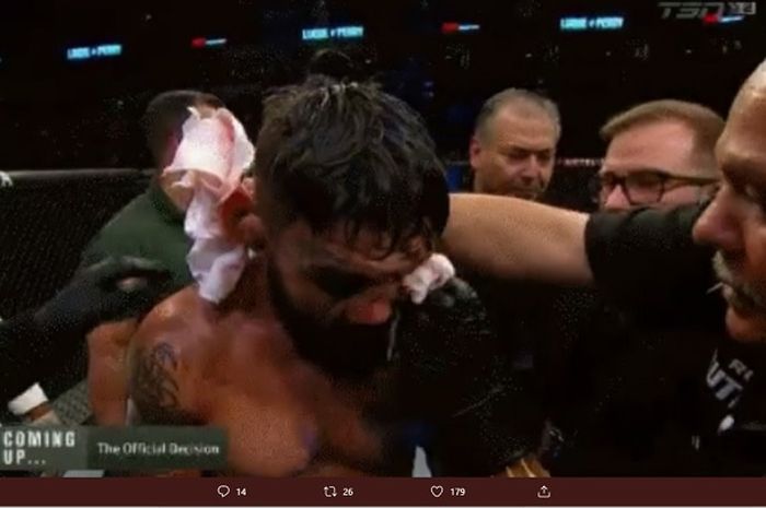 Petarung UFC Amerika Serikat, Mike Perry alami patah hidung terburuk sepanjang sejarah MMA ketika berlaga di Uruguay.