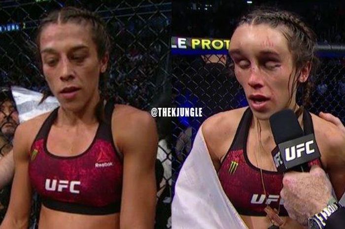 Joanna Jedrzejczyk setelah bertarung melawan Zhang Weili 