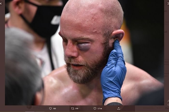 Cedera Justin Jaynes saat melawan Devonte Smith dalam UFC Vegas 18, Minggu (7/2/2021).