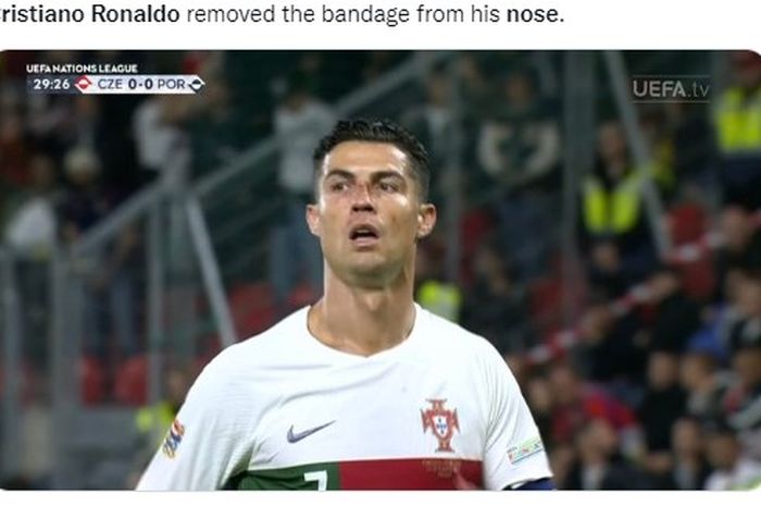 Hidung Cristiano Ronaldo berdarah saat membela timnas Portugal melawan Republik Ceko yang diperkuat pemain Persija Jakarta, Ondrej Kudela pada lanjutan Nations League grup A2.  
