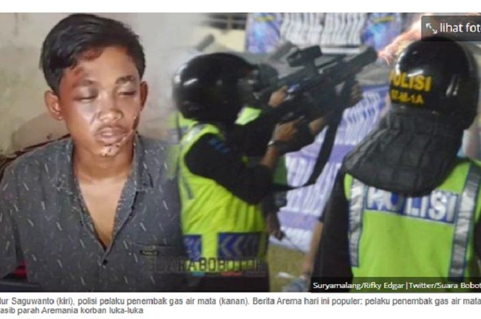 Nur Saguwanto, Aremania 19 tahun dengan mata melepuh korban gas air mata dan kaki patah saat tragedi Kanjuruhan.