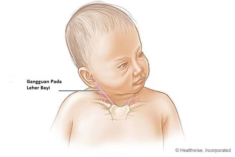 Anatomi kepala bayi