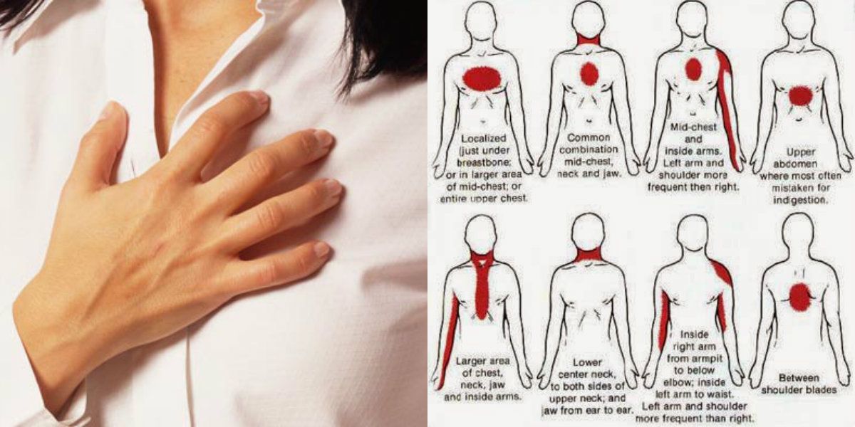 Catat Gejala Serangan Jantung Pada Wanita Bukan Nyeri Di Dada Semua Halaman Nakita