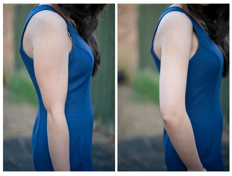 Cara Mengecilkan Otot Lengan