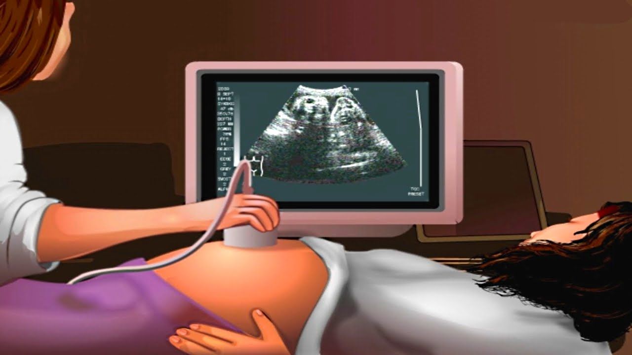 Perlu Moms Tahu Usg Selama Kehamilan Sebenarnya Cukup Tiga Kali Semua Halaman Nakita