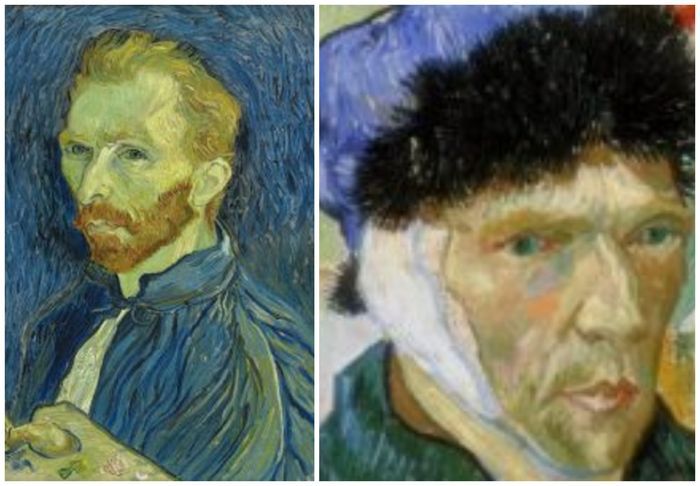 Van Gogh motong telinganya karena mabuk