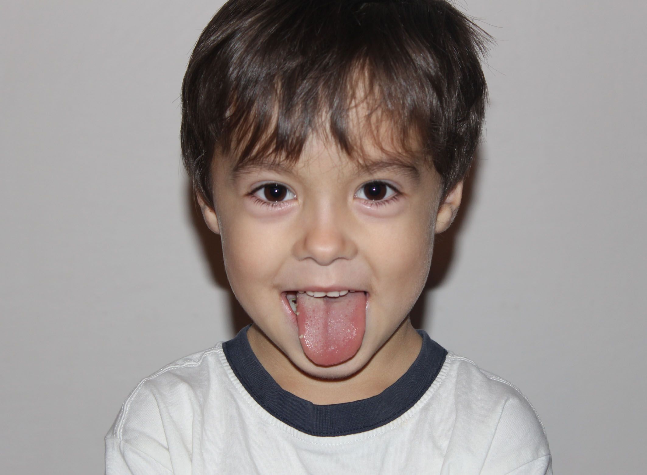 Meski Sering Dianggap Menjijikkan Saliva Punya 4 Manfaat Bagi Kita Semua Halaman Bobo