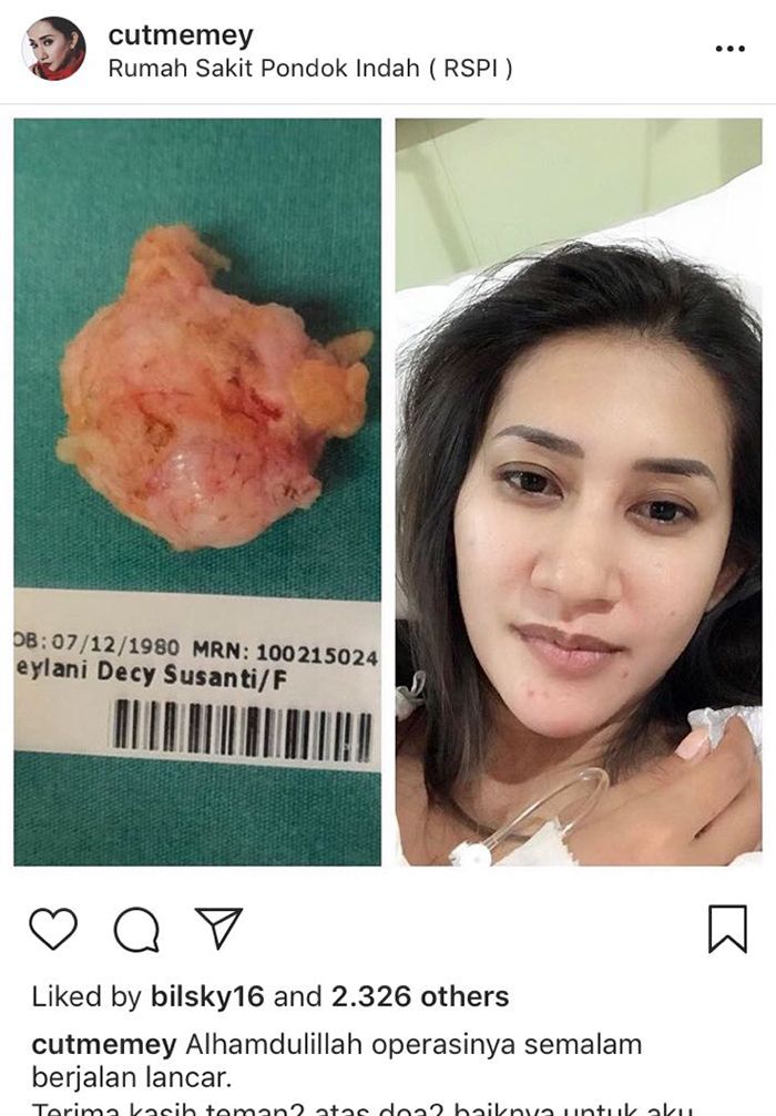Kondisi Drop Pasca Operasi Tumor Payudara Cut Memey Langsung Pulih Setelah Konsumsi Sayur Ini Semua Halaman Sajian Sedap<script async src=