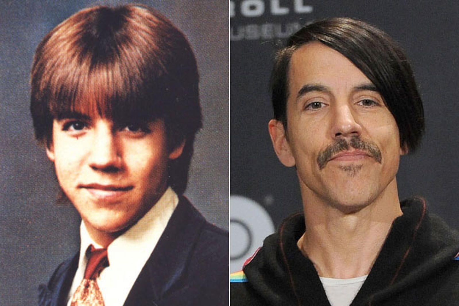 Anthony Kiedis