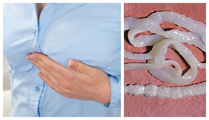 Bisa Sebabkan Pembuluh Darah Pecah Cacing Pita Mudah Masuk Ke Dalam Tubuh Jika Kita Tak Lakukan Ini Saat Masak Semua Halaman Intisari Bisa Sebabkan Pembuluh Darah Pecah Cacing Pita Mudah Masuk Ke Dalam Tubuh Jika Kita Tak Lakukan Ini Saat Masak Semua Halaman Intisari