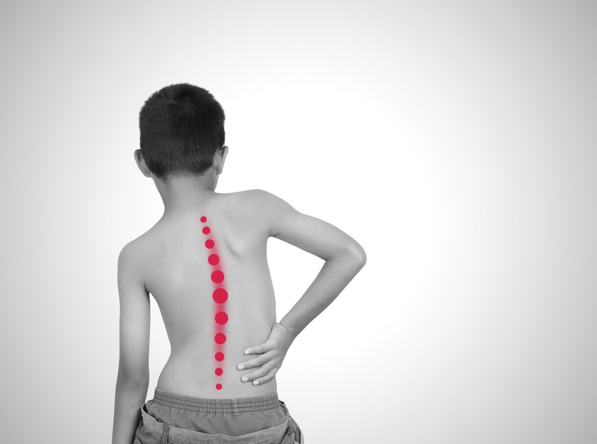 Kelainan Tulang Belakang Rentan Dialami Anak Anak Dan Sulit Disembuhkan Waspadai Tanda Tandanya Semua Halaman Grid Health Kelainan Tulang Belakang Rentan Dialami Anak Anak Dan Sulit Disembuhkan Waspadai Tanda Tandanya Semua Halaman Grid Health