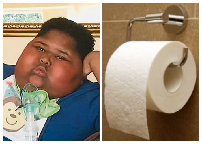 Tak Pernah Merasa Kenyang, Bocah Ini Sampai Lahap Tisu Toilet Hingga Obesitas