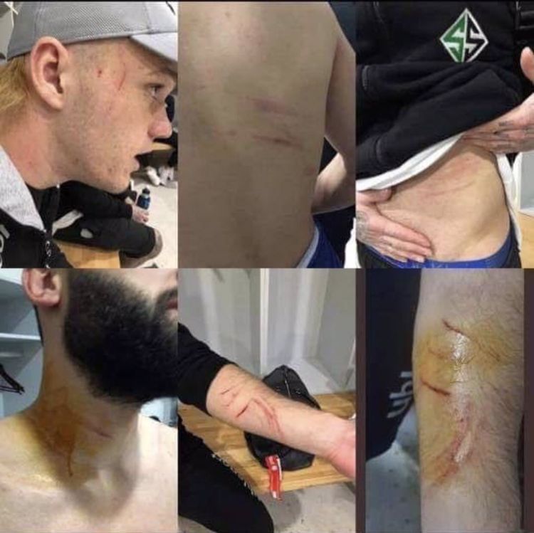 Pemain lawan mengunggah foto luka yang mereka alami. 