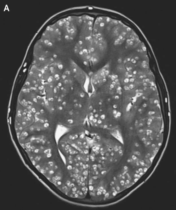 Foto scan MRI otak remaja tersebut.